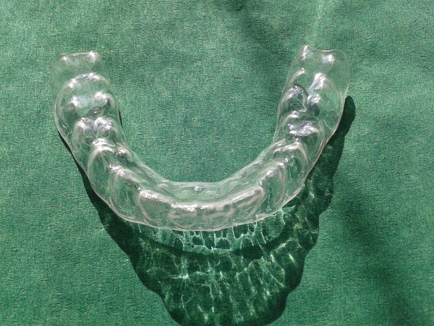 Dentalna udlaga 001